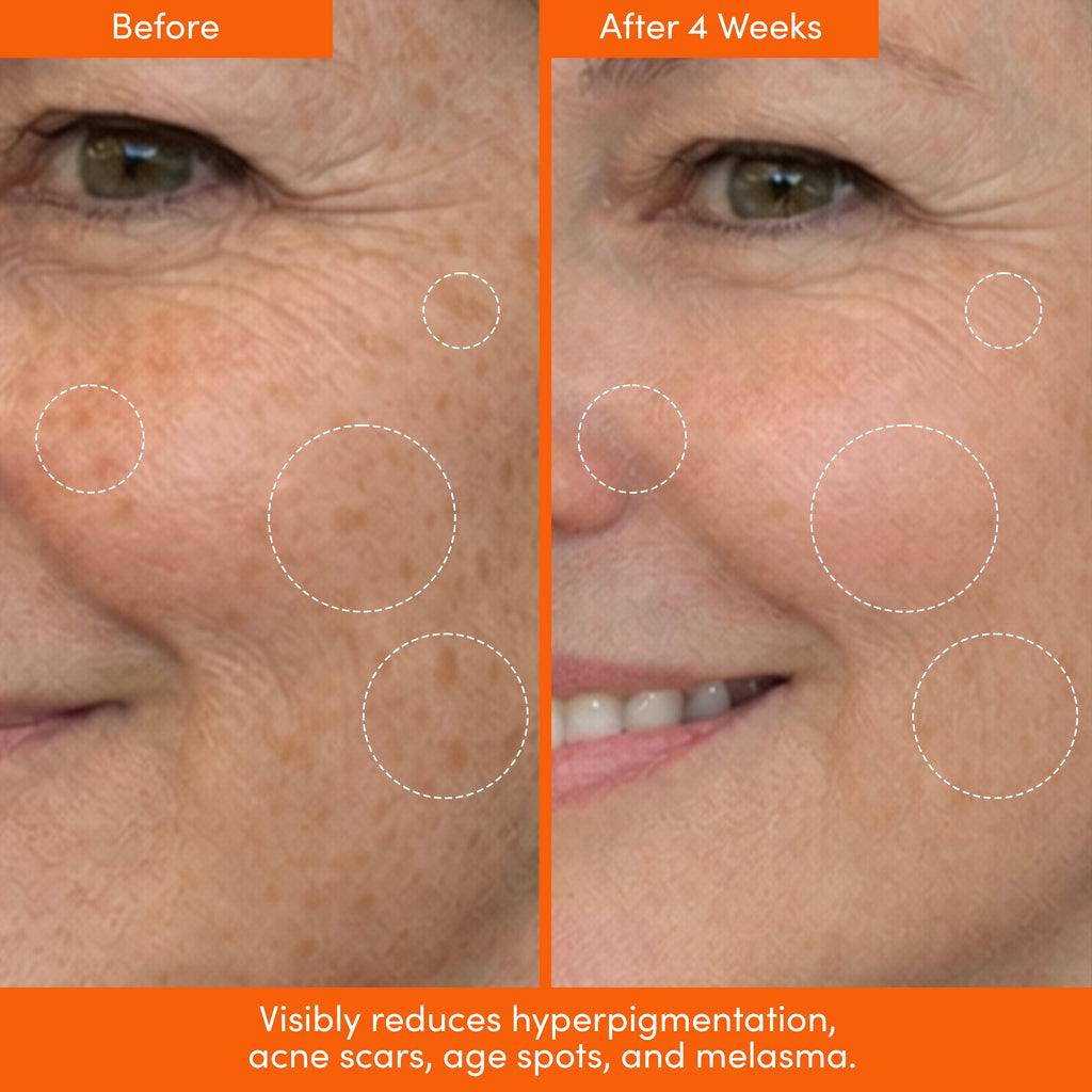 COMPOUND SKINTEREST Everything Bundle – AHA + Barrier + SPF
