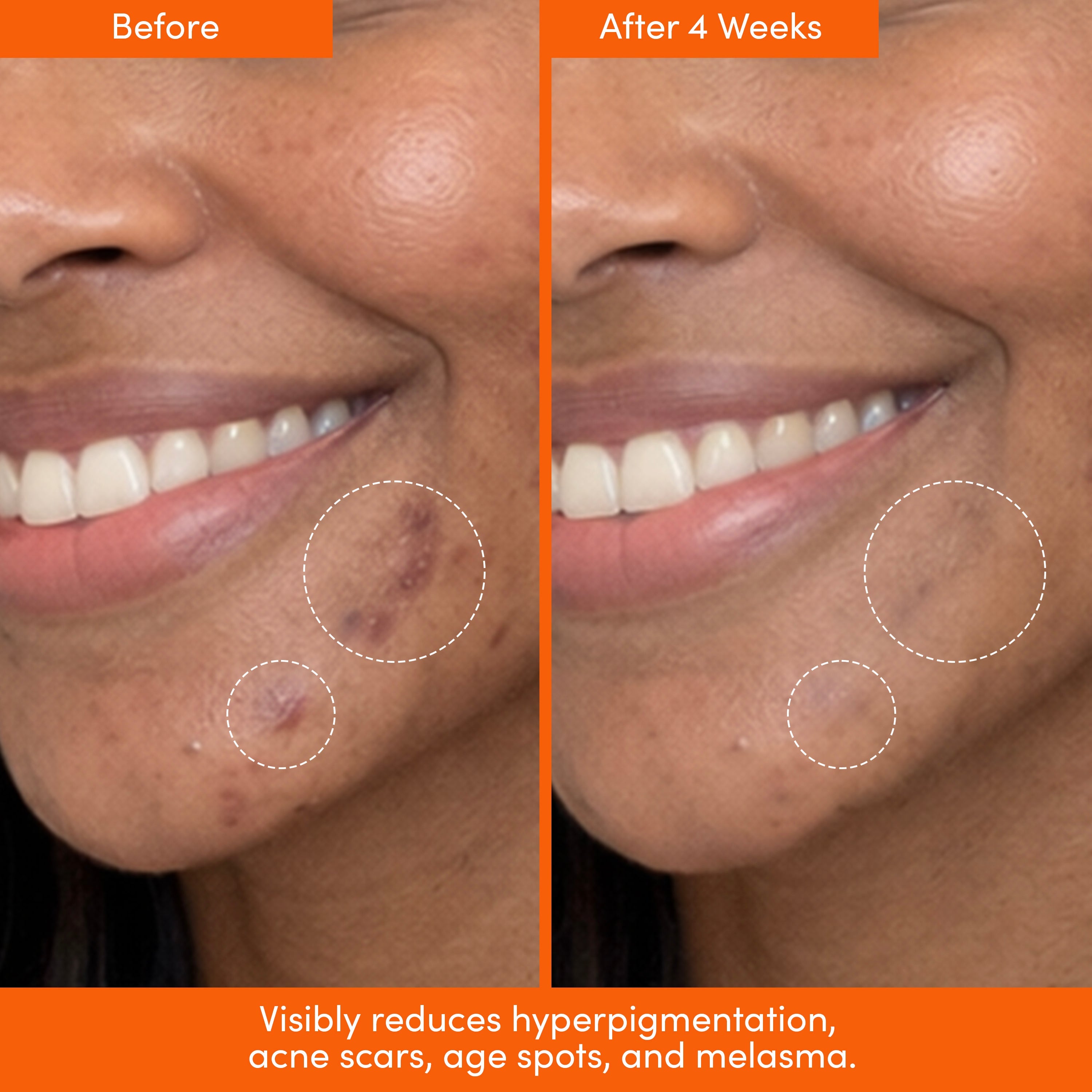 THE PLACENTA FACIAL – Dark Spot Serum + Barrier Repair Cream Bundle