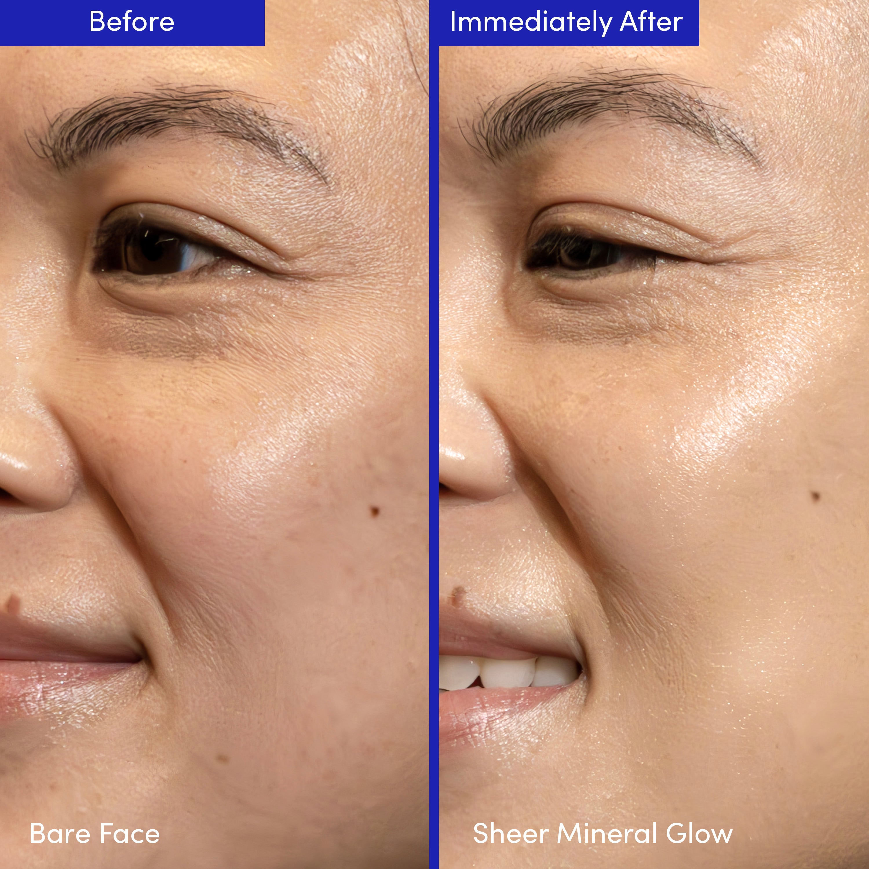 COMPOUND SKINTEREST Everything Bundle – AHA + Barrier + SPF