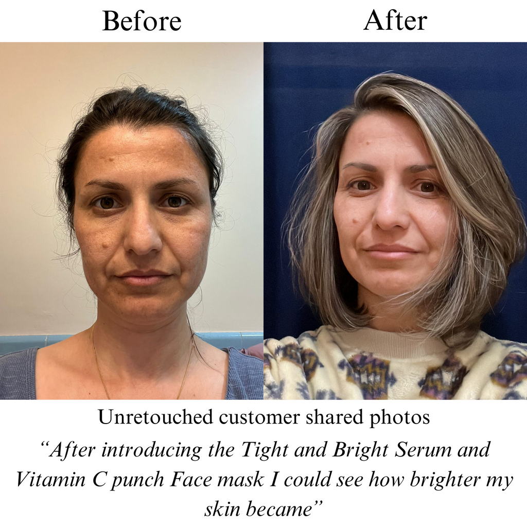 TIGHT AND BRIGHT Advanced Phyto-Retinol & Vitamin C Serum
