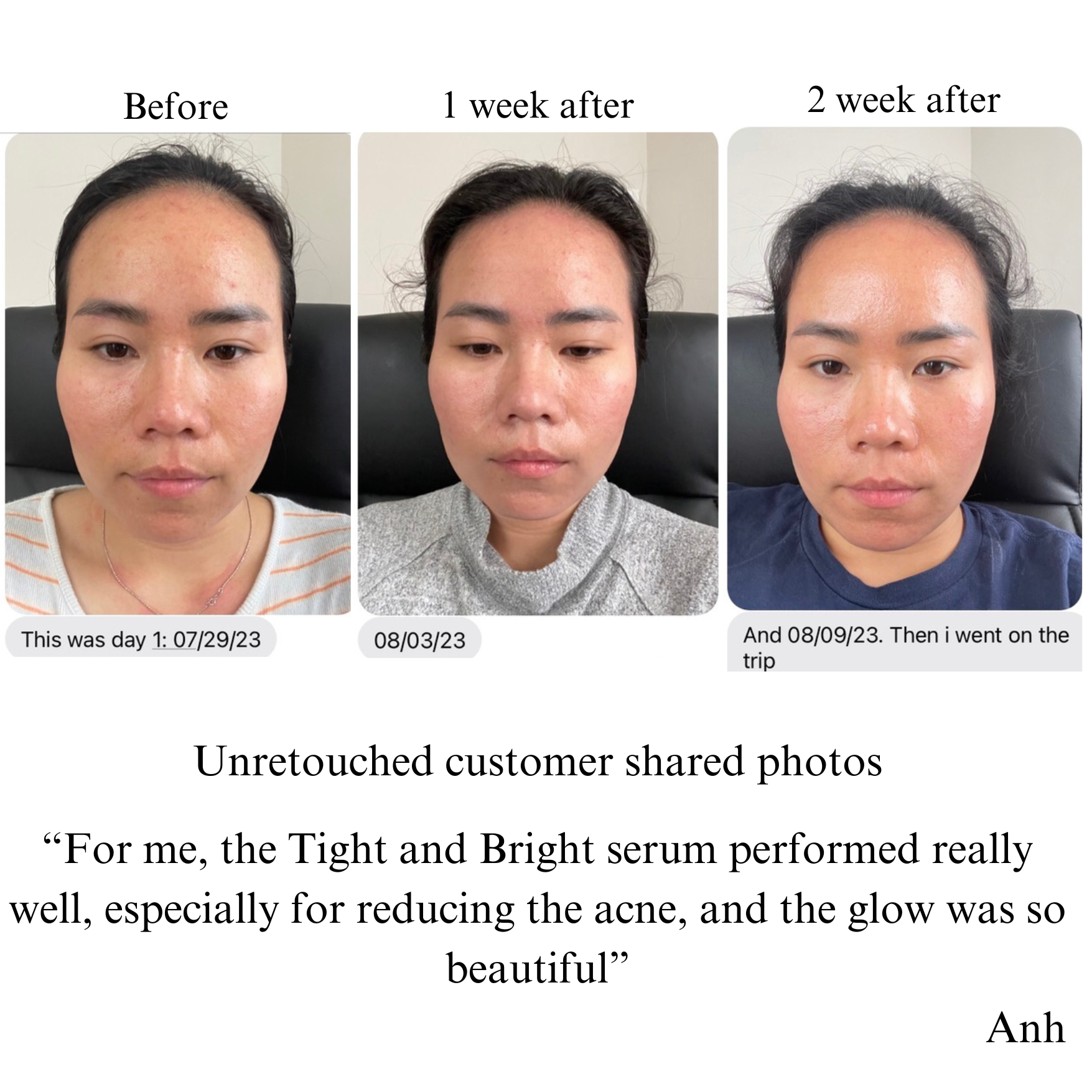 TIGHT AND BRIGHT Advanced Phyto-Retinol & Vitamin C Serum