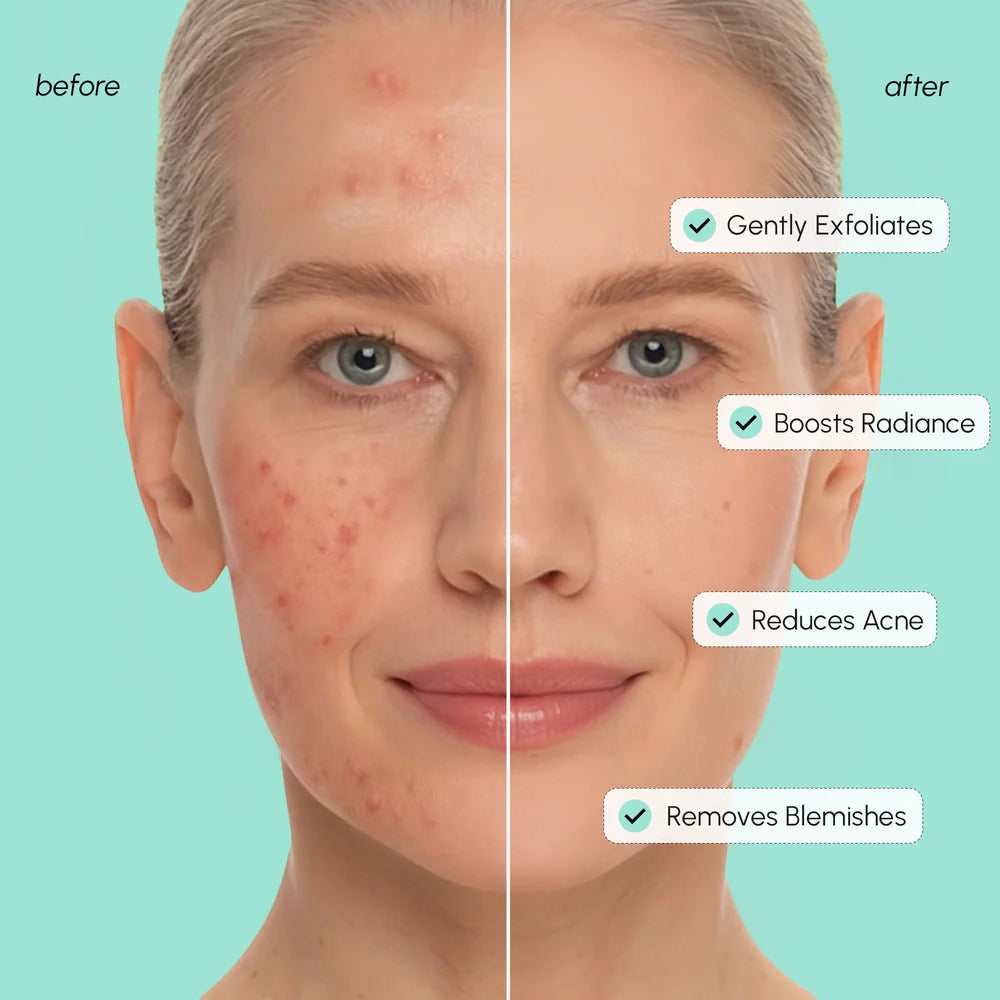 Azelaic Acid Soothing & Brightening Toner Pads