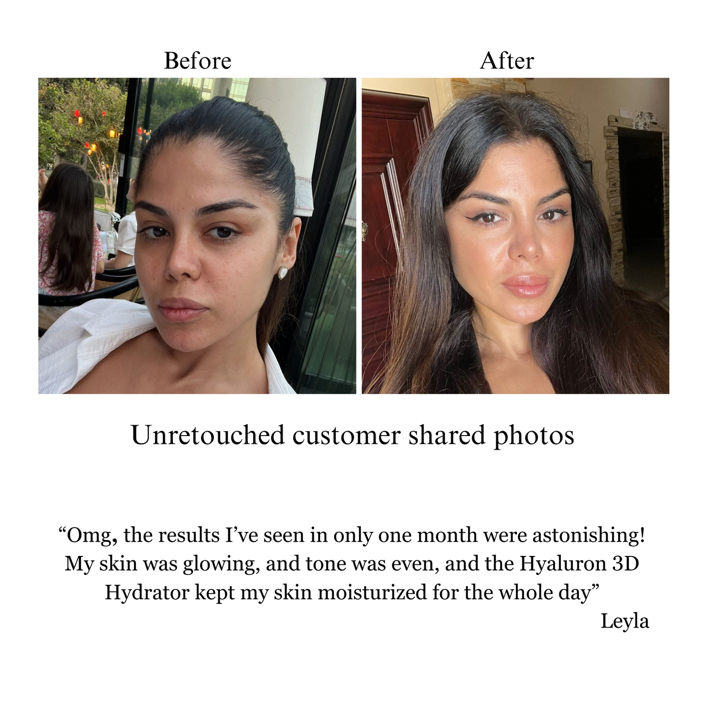 Hyaluron 3D Hydrator Multi Lamellar Face & Neck Cream-Serum