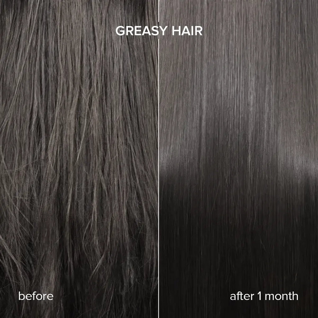 Keratin Oil Serum – Frizz Control & Repair for Dry & Damaged Hair