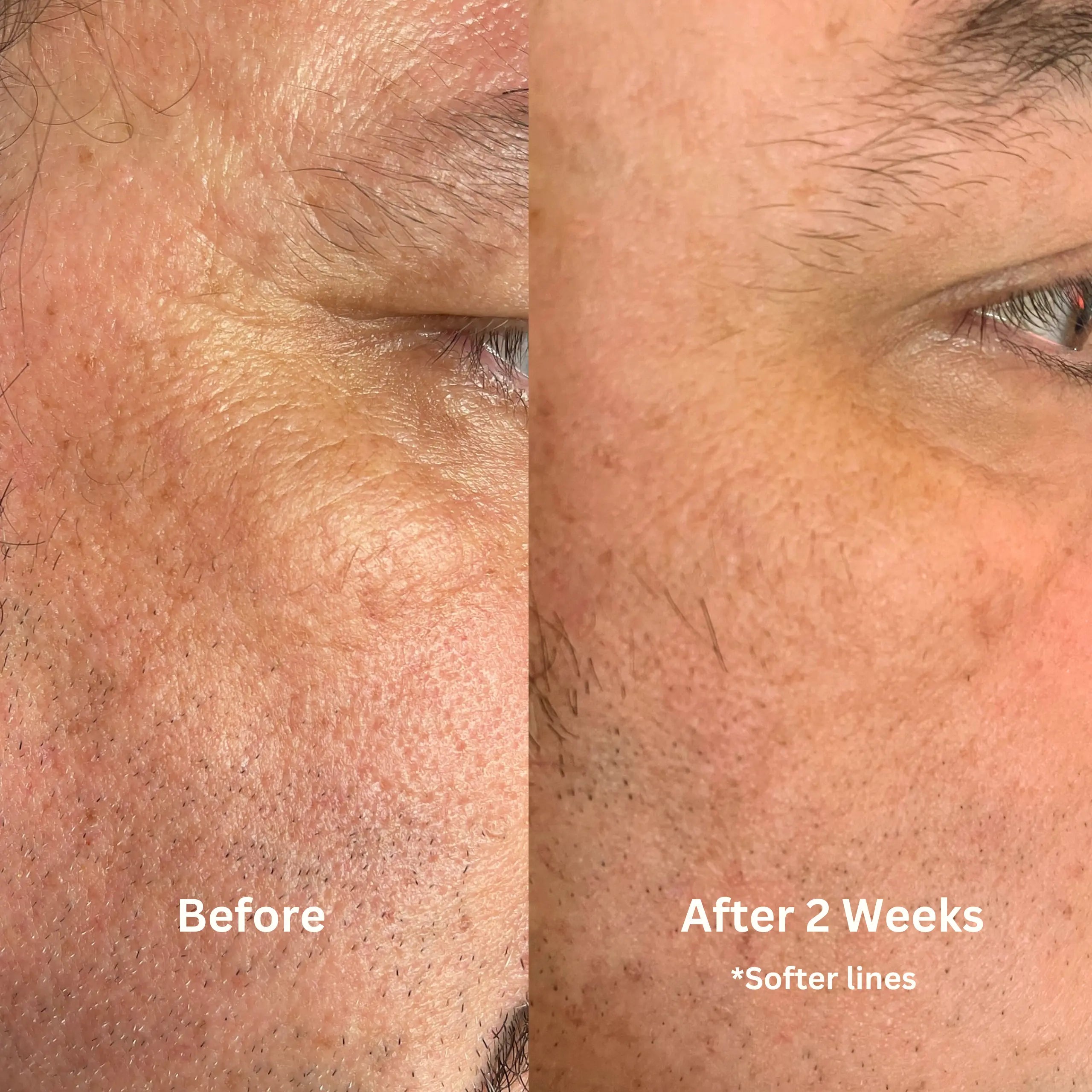 Luster Bakuchiol + Astaxanthin Face Oil — Retinol Alternative