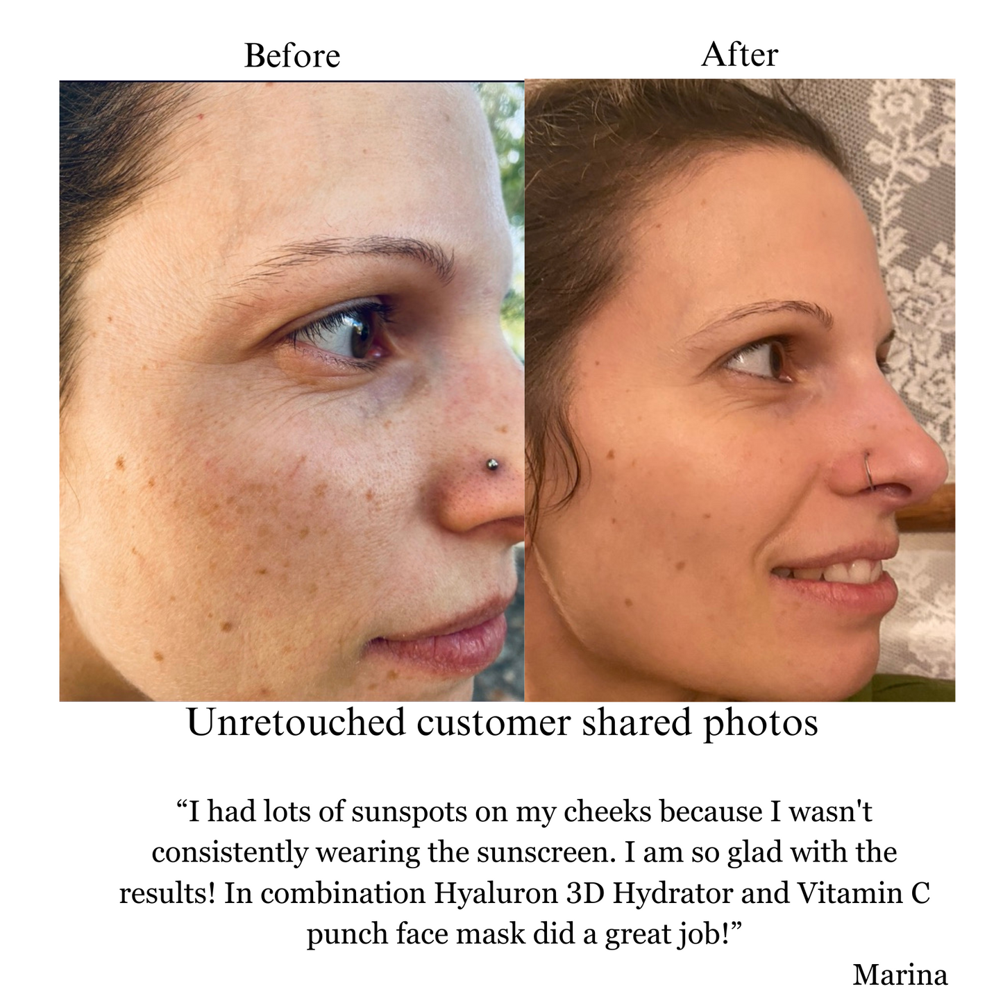 Hyaluron 3D Hydrator Multi Lamellar Face & Neck Cream-Serum