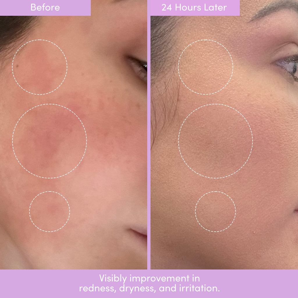 THE PLACENTA FACIAL – Dark Spot Serum + Barrier Repair Cream Bundle