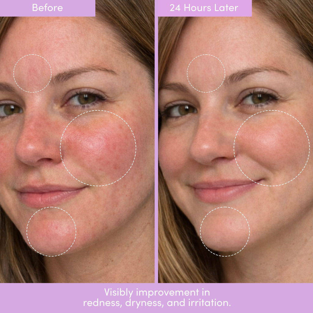 THE PLACENTA FACIAL – Dark Spot Serum + Barrier Repair Cream Bundle