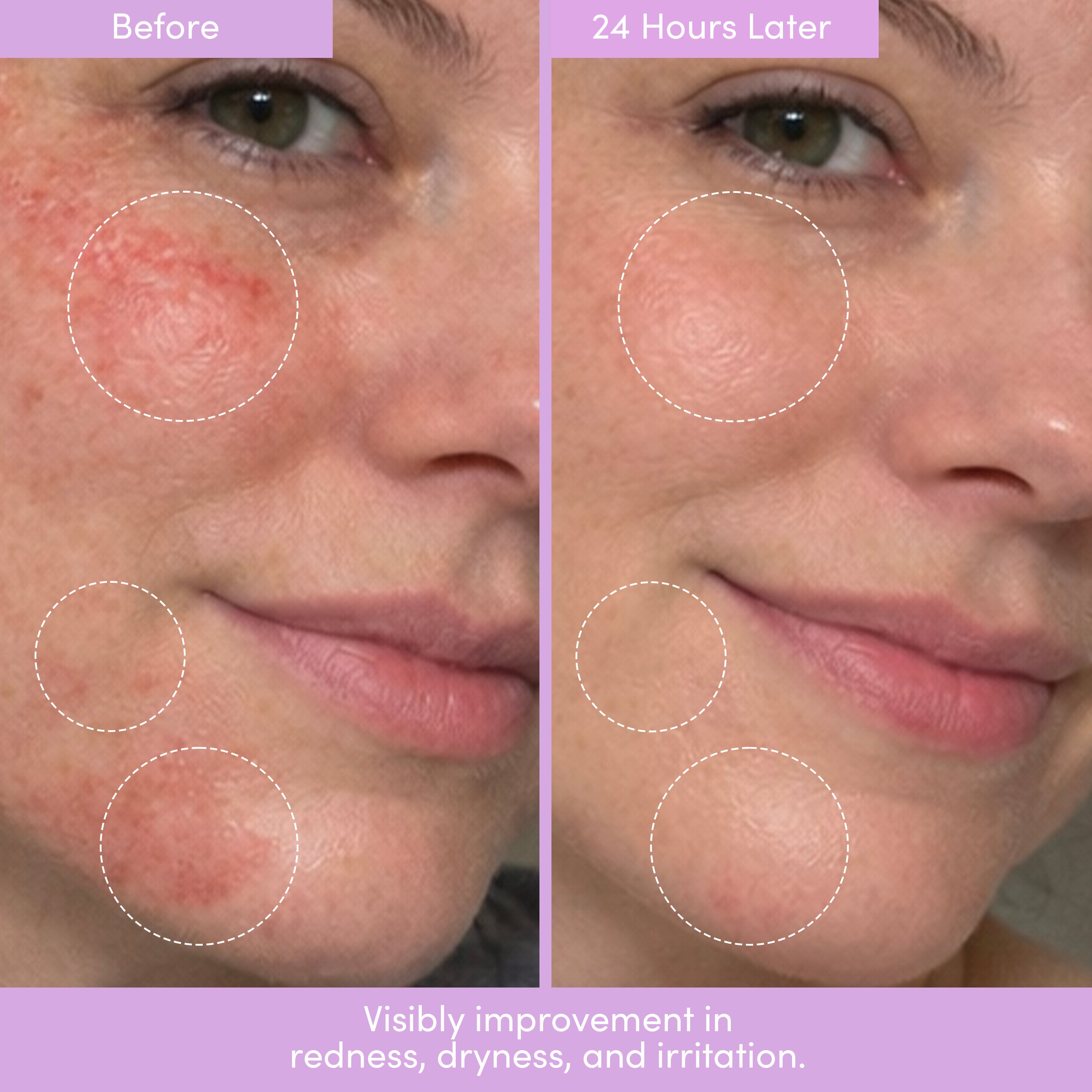 COMPOUND SKINTEREST Everything Bundle – AHA + Barrier + SPF