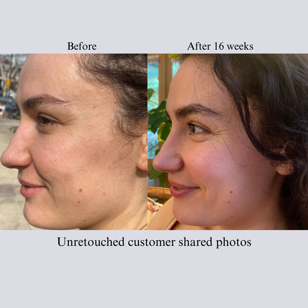 Hyaluron 3D Hydrator Multi Lamellar Face & Neck Cream-Serum