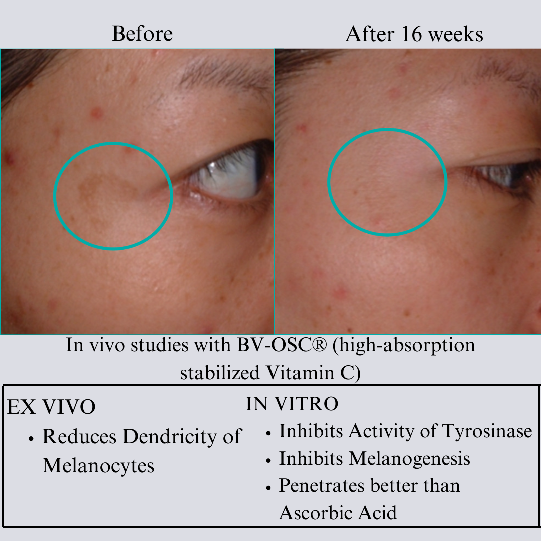 TIGHT AND BRIGHT Advanced Phyto-Retinol & Vitamin C Serum