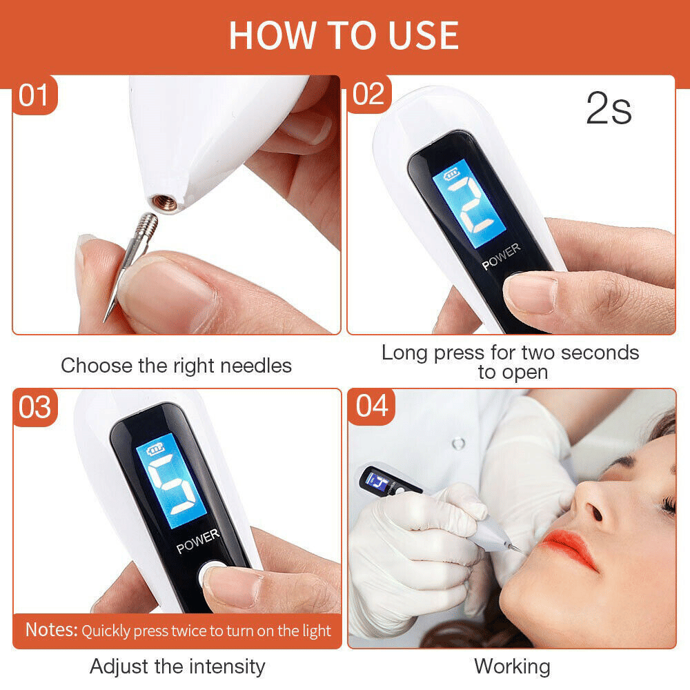 Electric Laser Plasma Pen — Mole, Wart & Dark Spot Removal Device
