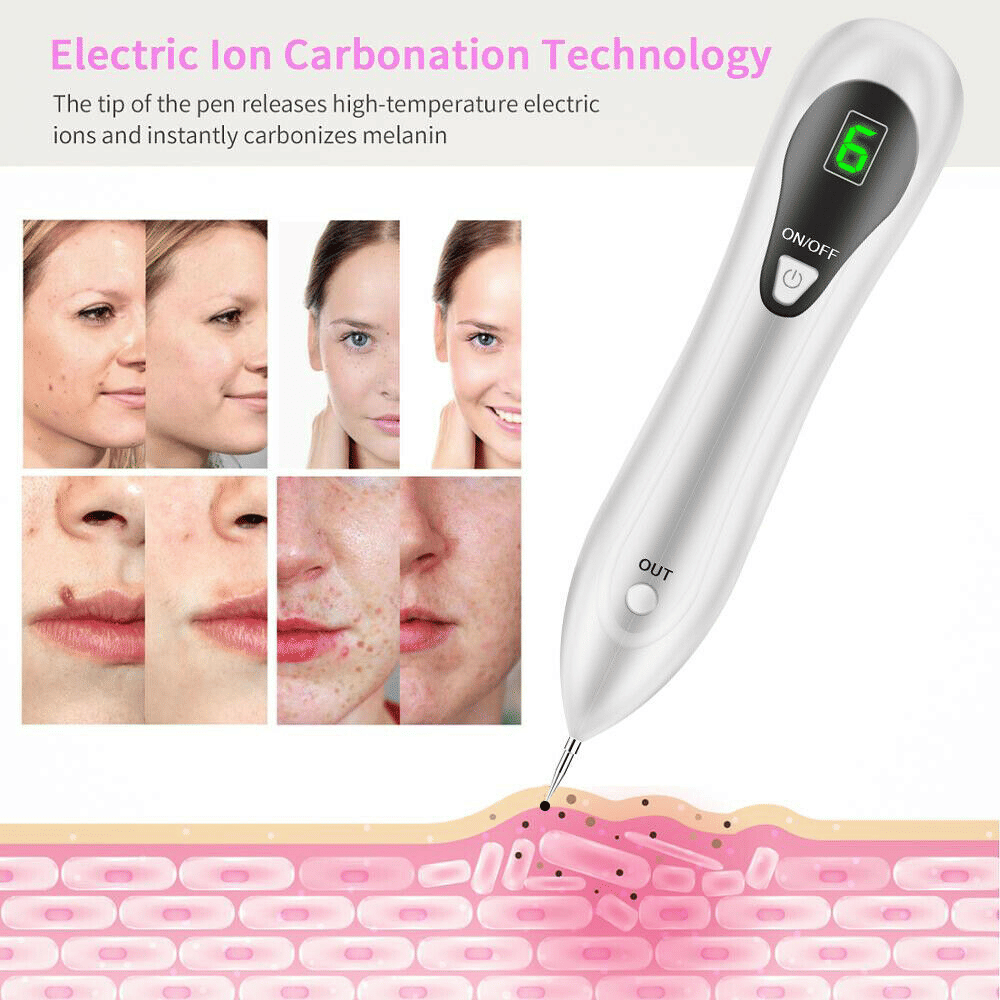 Electric Laser Plasma Pen — Mole, Wart & Dark Spot Removal Device
