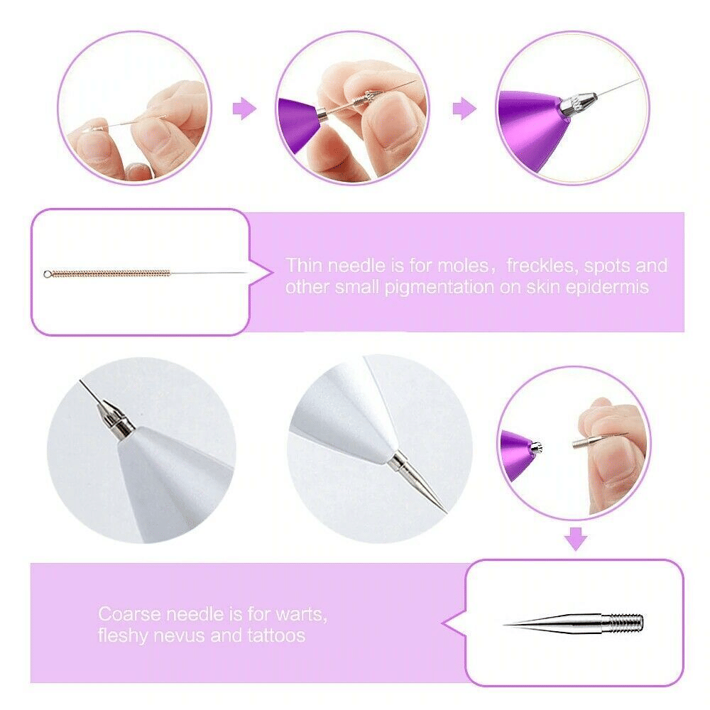 Electric Laser Plasma Pen — Mole, Wart & Dark Spot Removal Device