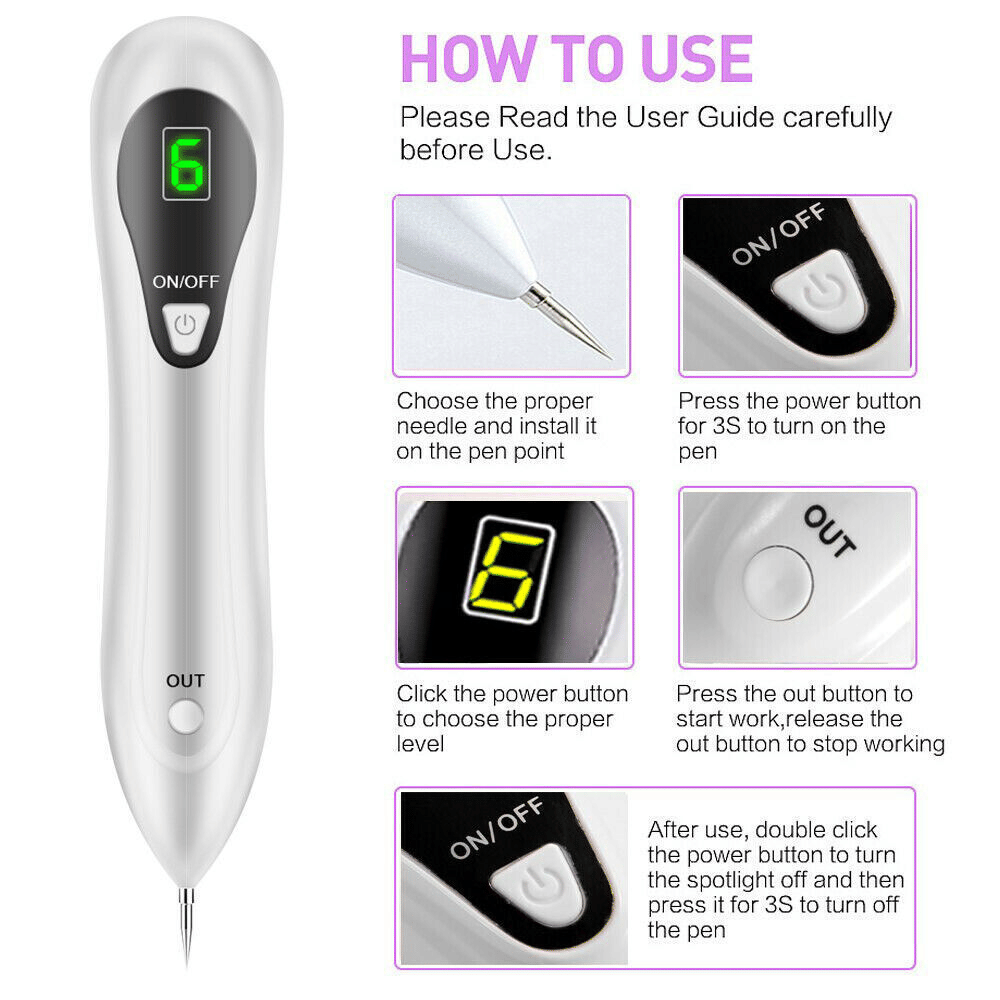 Electric Laser Plasma Pen — Mole, Wart & Dark Spot Removal Device