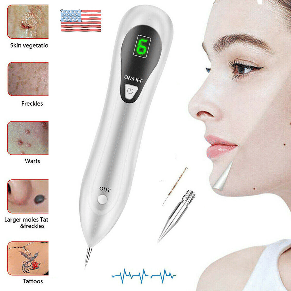 Electric Laser Plasma Pen — Mole, Wart & Dark Spot Removal Device