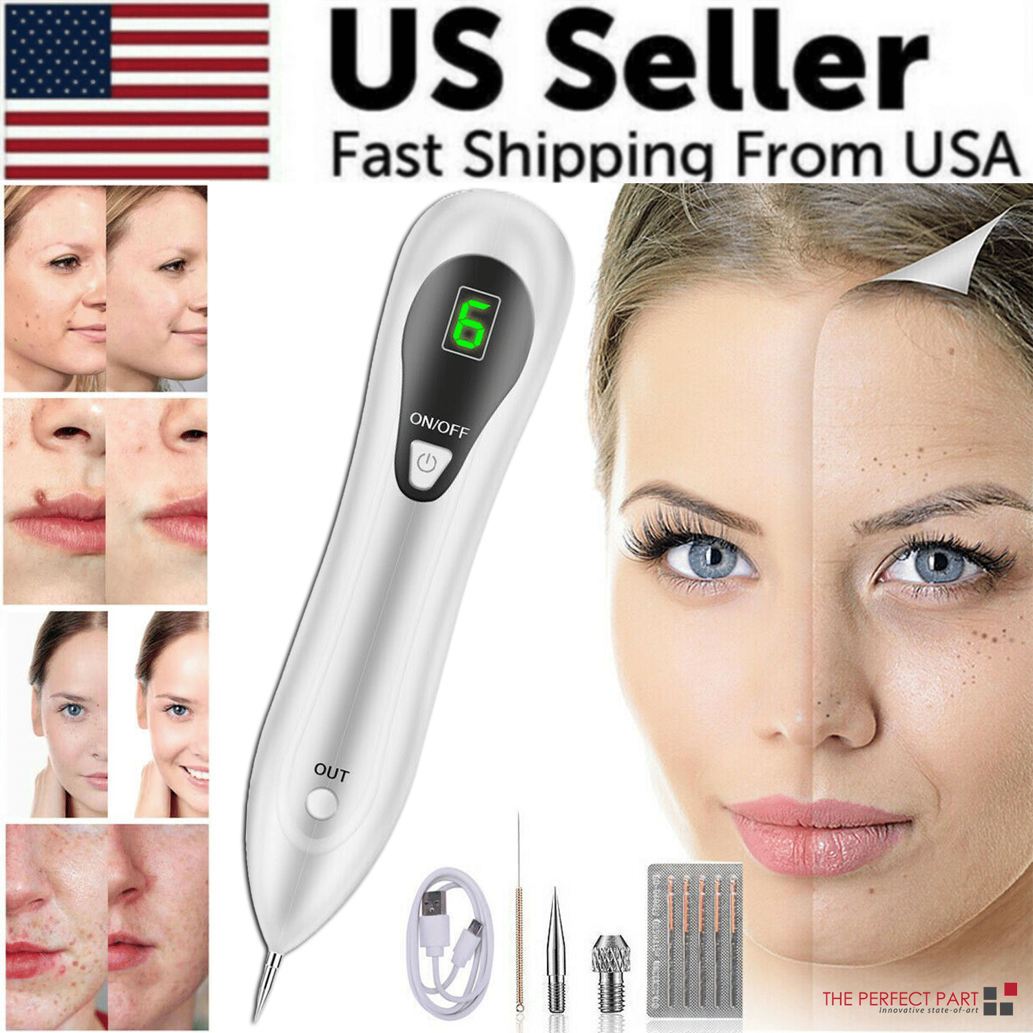 Electric Laser Plasma Pen — Mole, Wart & Dark Spot Removal Device