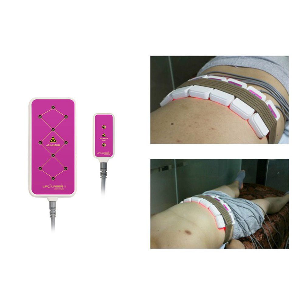 Shape Tactics 160mW LED Laser Lipo Body Contouring System — 8-Pad