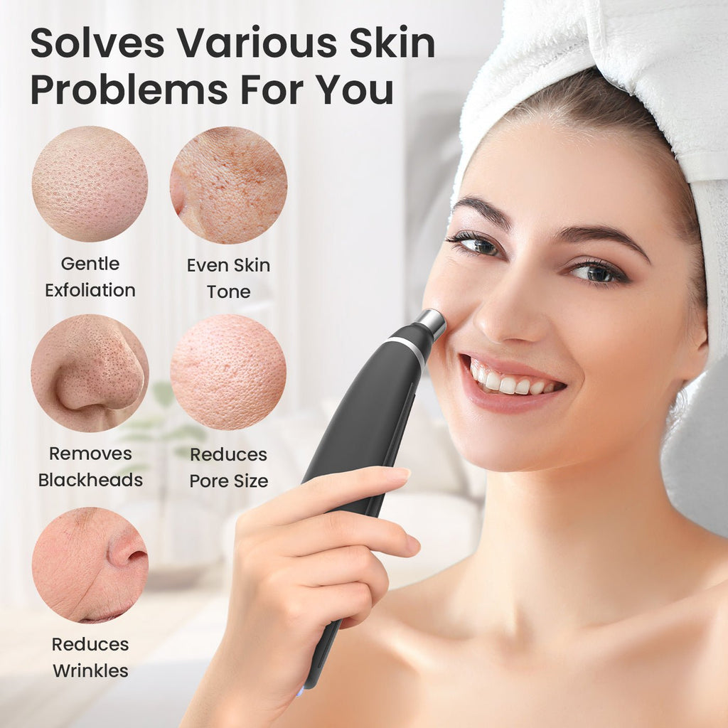 Shape Tactics 12-Tip Portable Diamond Microdermabrasion Kit