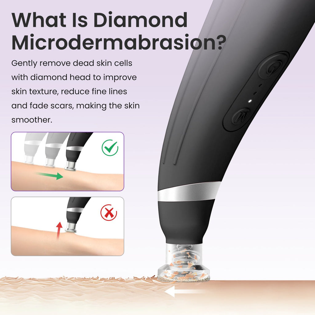 Shape Tactics 12-Tip Portable Diamond Microdermabrasion Kit