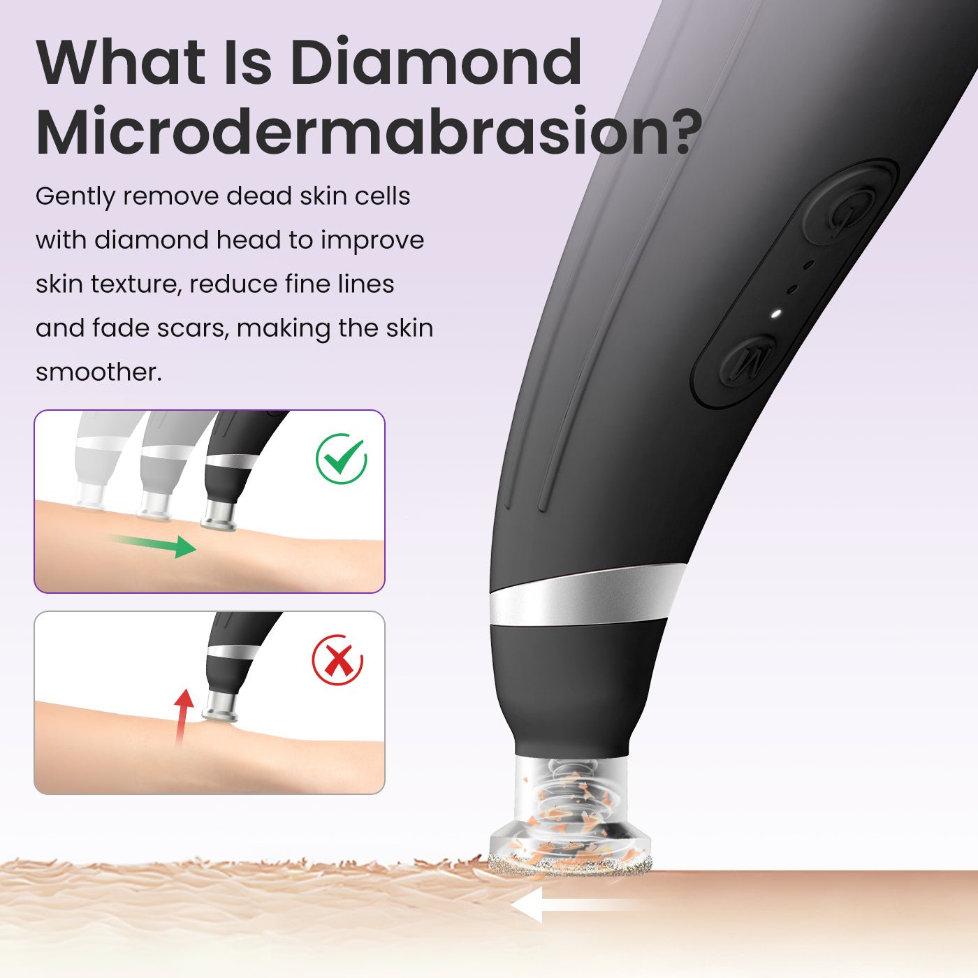 Shape Tactics 12-Tip Portable Diamond Microdermabrasion Kit