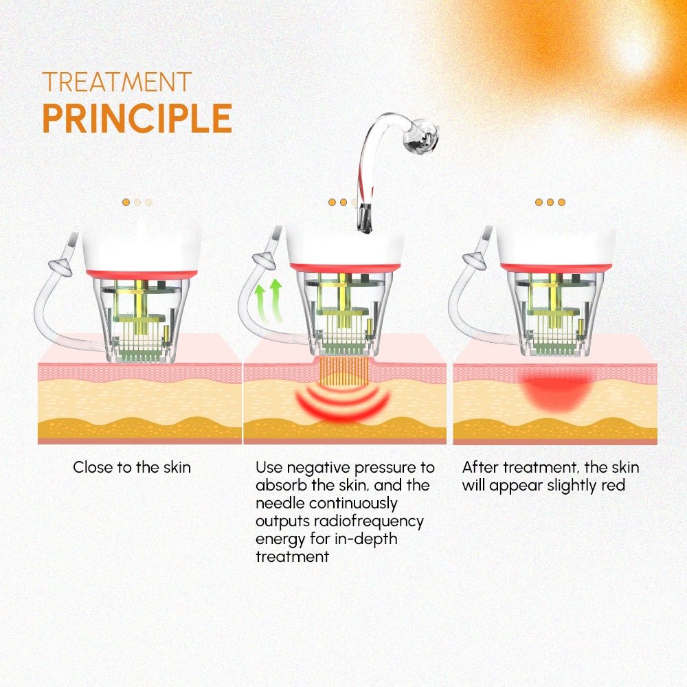 Shape Tactics 3-in-1 RF Microneedling, Cold Hammer & Vacuum Skin Rejuvenation System