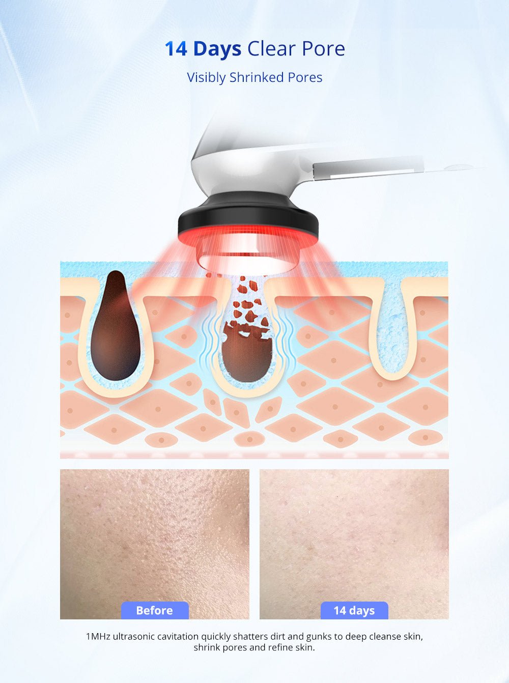 Shape Tactics 3-in-1 Ultrasonic Facial EMS LED Photon Therapy