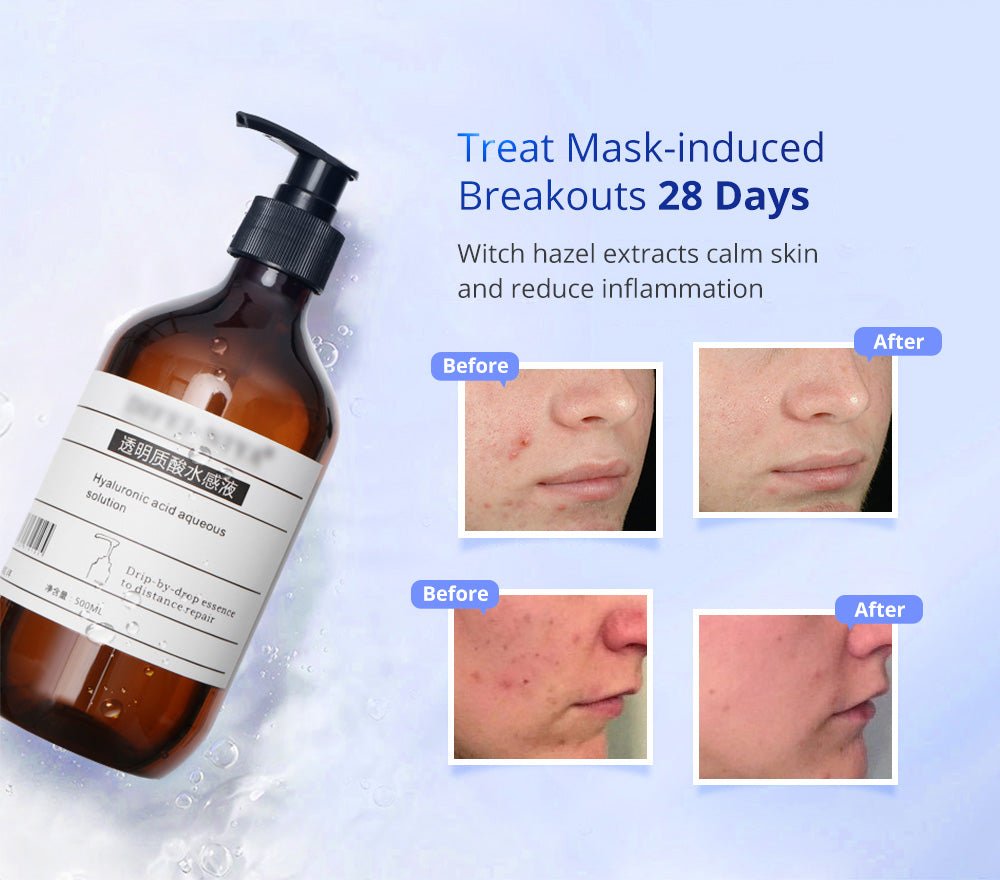 Shape Tactics 3-in-1 Ultrasonic Facial EMS LED Photon Therapy