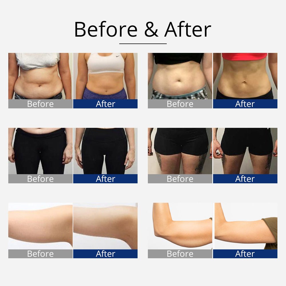Shape Tactics 360° 3D Rotating RF Cavitation & Vacuum Body Contouring System