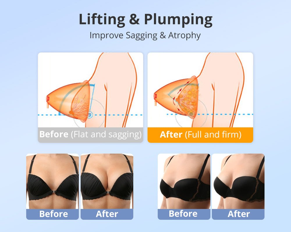 Shape Tactics 40K Cavitation Multi-Polar RF & Vacuum Cup Body Contouring System