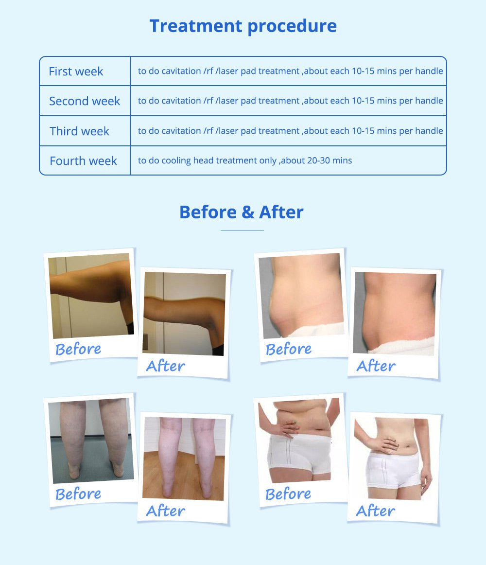 Shape Tactics 5-in-1 Cavitation Cryolipolysis RF & LED Laser Lipo Body Contouring System