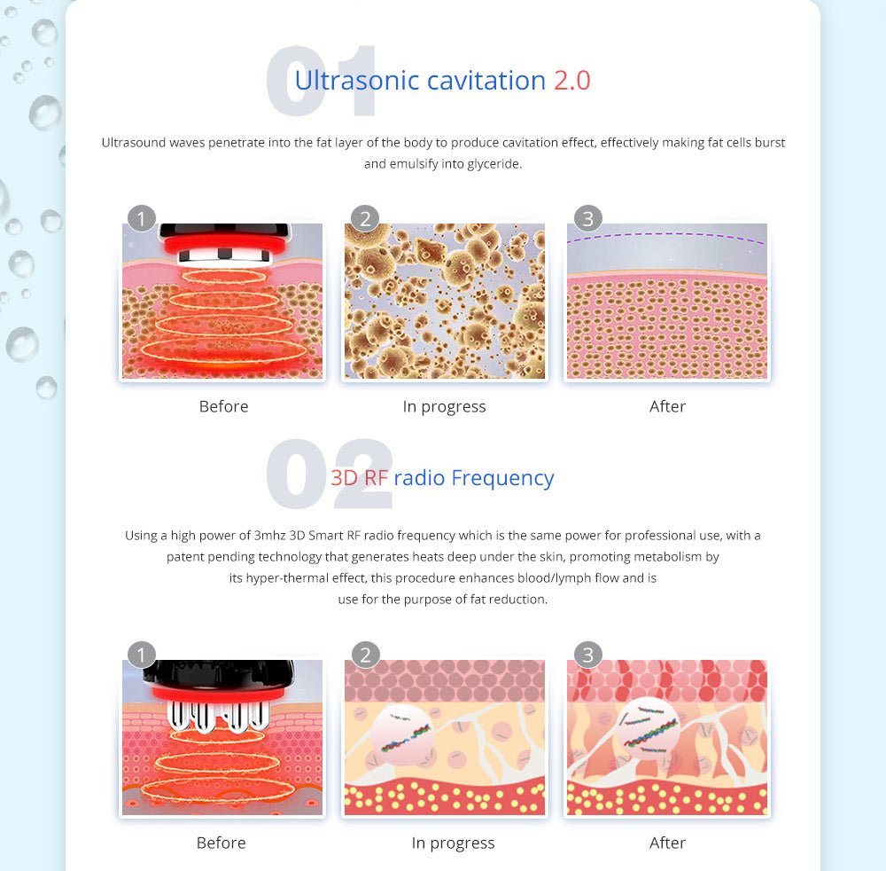 Shape Tactics 5-in-1 Cavitation Cryolipolysis RF & LED Laser Lipo Body Contouring System