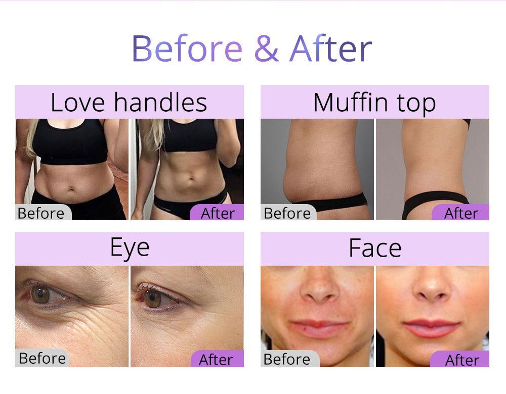 Shape Tactics 5-in-1 80K Cavitation Multi-Polar RF & LED Laser Lipo Body Contouring System