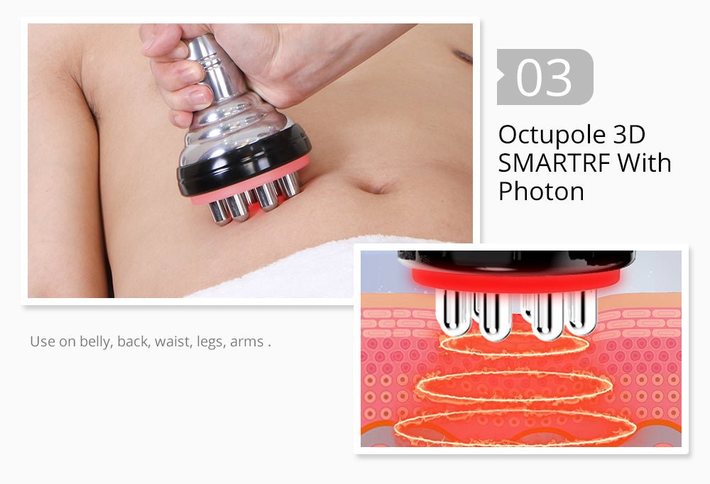 Shape Tactics 5-in-1 Unoisetion Cavitation 2.0 & 3D SMART RF Body Contouring System