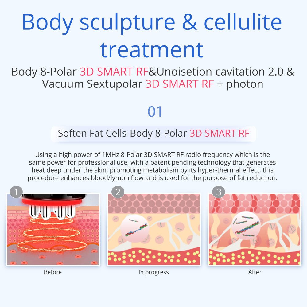 Shape Tactics 5-in-1 Unoisetion Cavitation & SMART 3D RF Body Contouring System