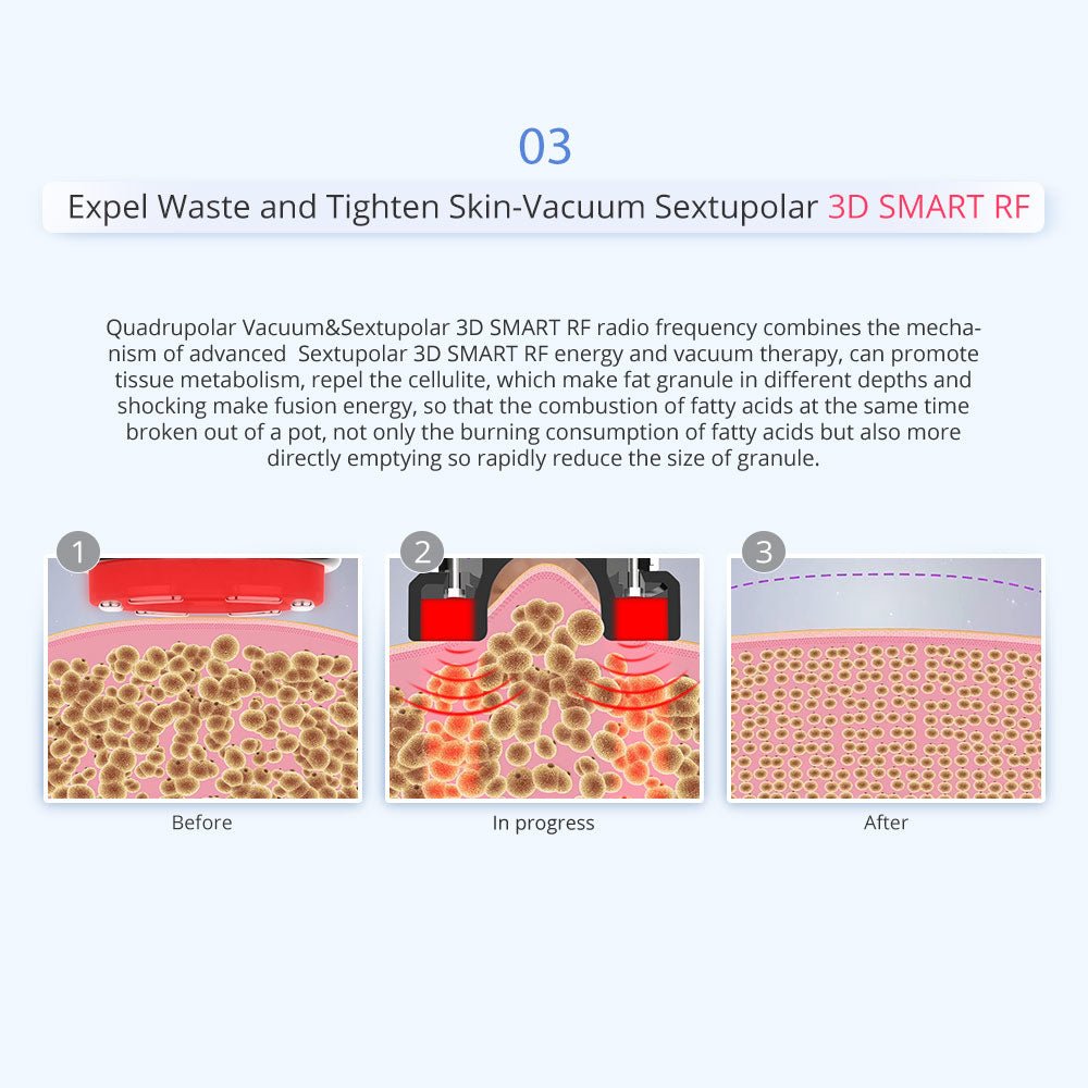 Shape Tactics 5-in-1 Unoisetion Cavitation & SMART 3D RF Body Contouring System