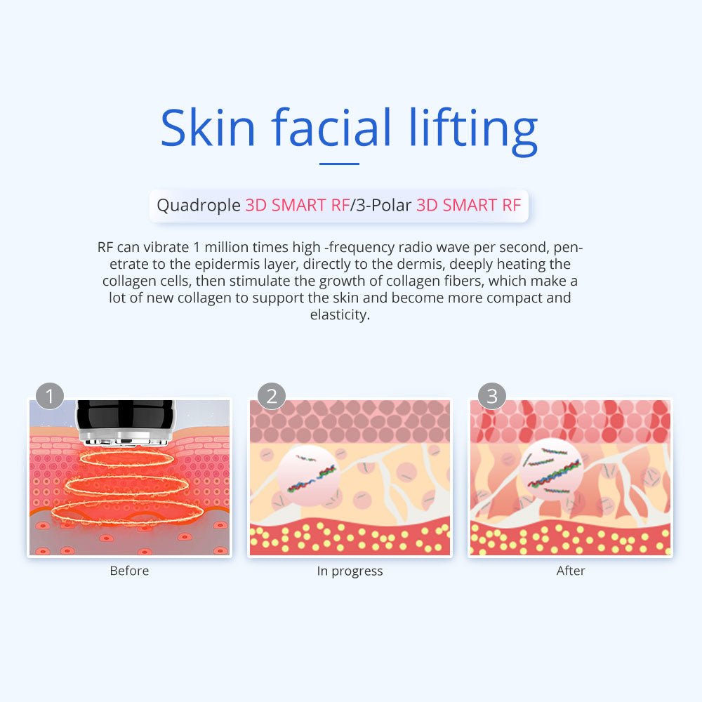 Shape Tactics 5-in-1 Unoisetion Cavitation & SMART 3D RF Body Contouring System
