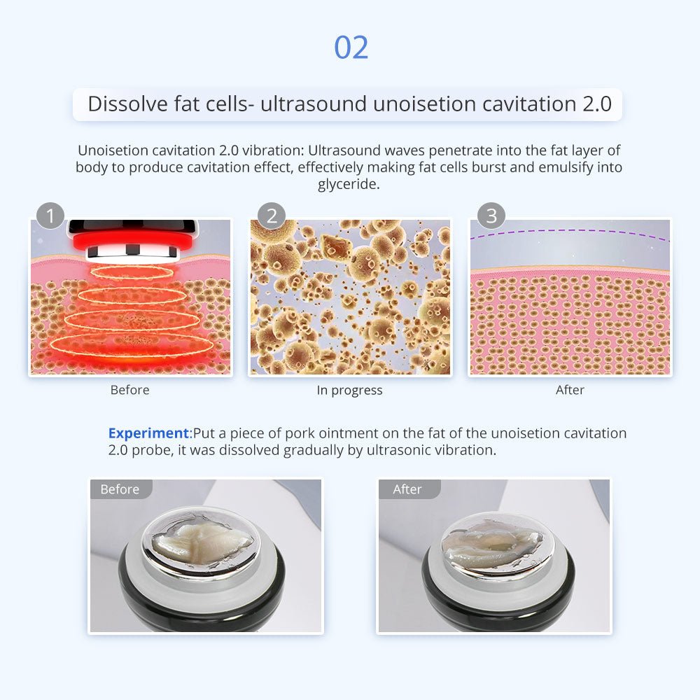 Shape Tactics 5-in-1 Unoisetion Cavitation & SMART 3D RF Body Contouring System