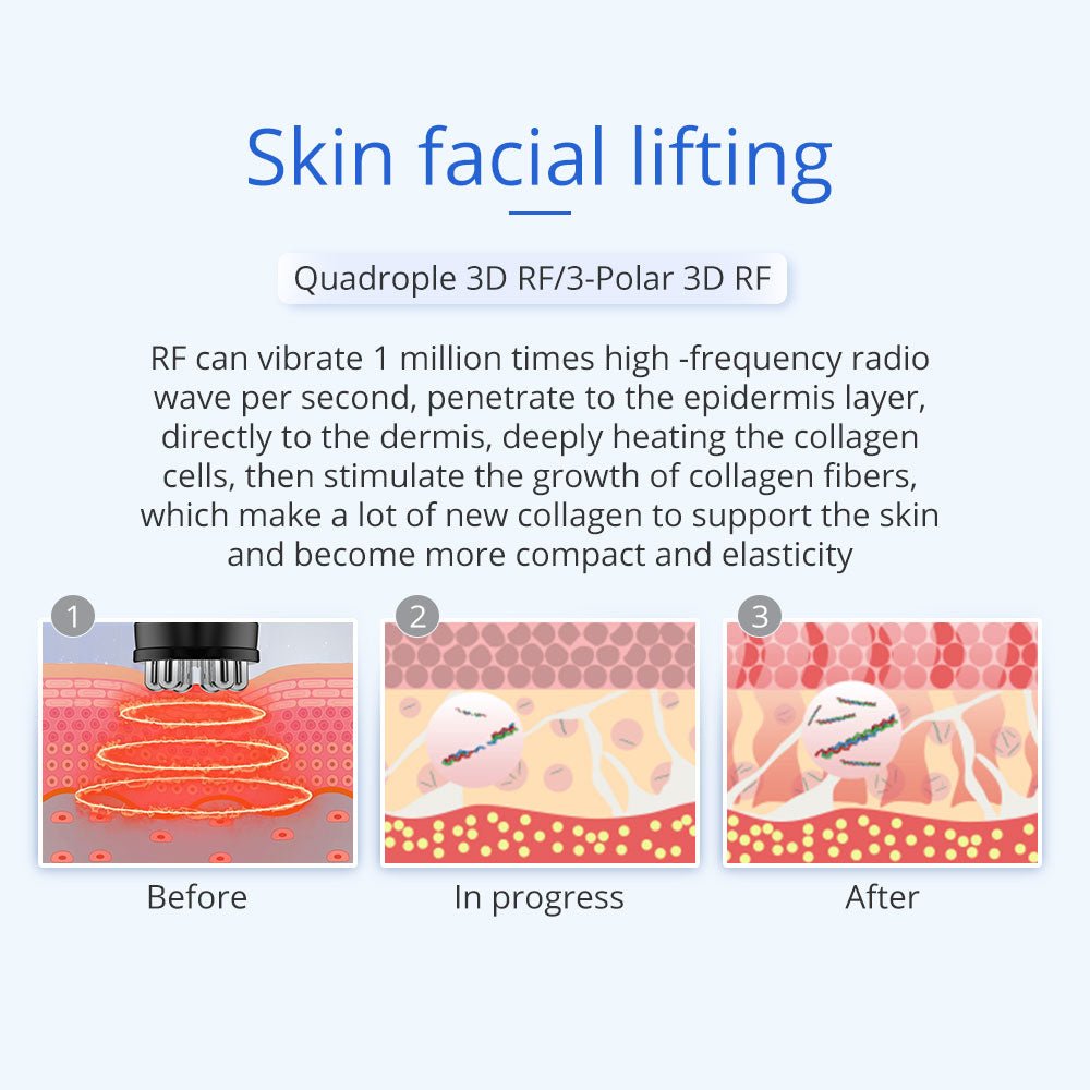 Shape Tactics 5-in-1 Unoisetion 40K Cavitation & Multi-Polar RF Body Contouring System