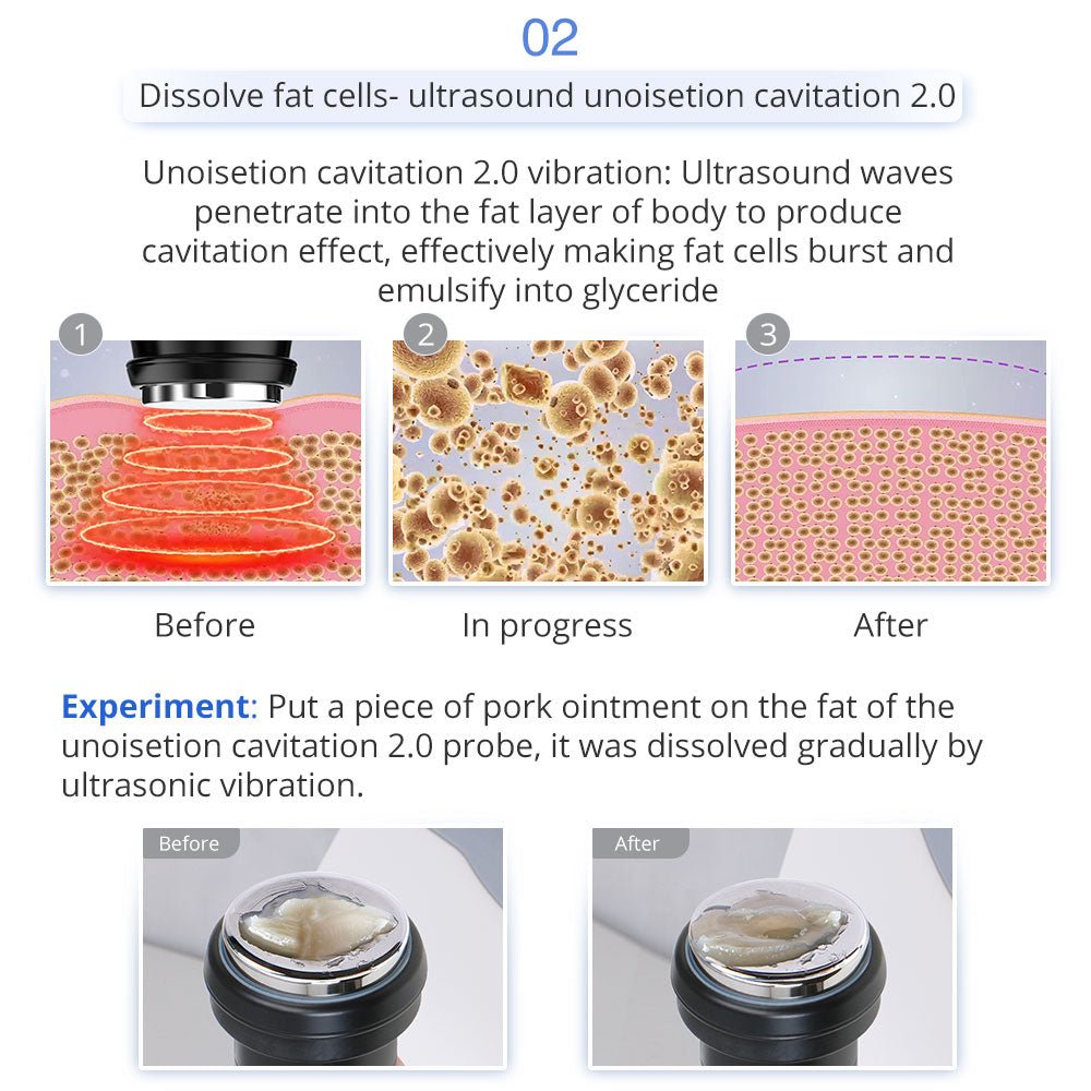 Shape Tactics 5-in-1 Unoisetion 40K Cavitation & Multi-Polar RF Body Contouring System