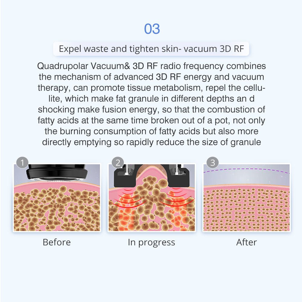 Shape Tactics 5-in-1 Unoisetion 40K Cavitation & Multi-Polar RF Body Contouring System