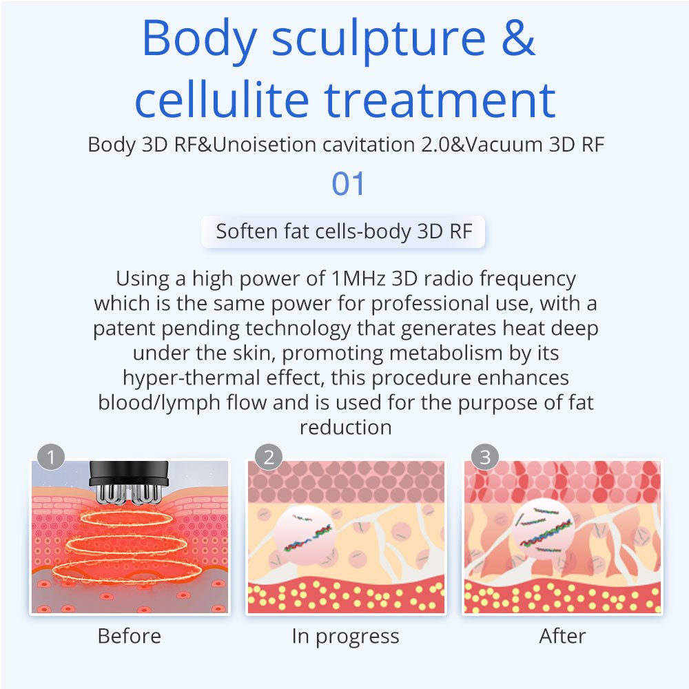 Shape Tactics 5-in-1 Unoisetion 40K Cavitation & Multi-Polar RF Body Contouring System