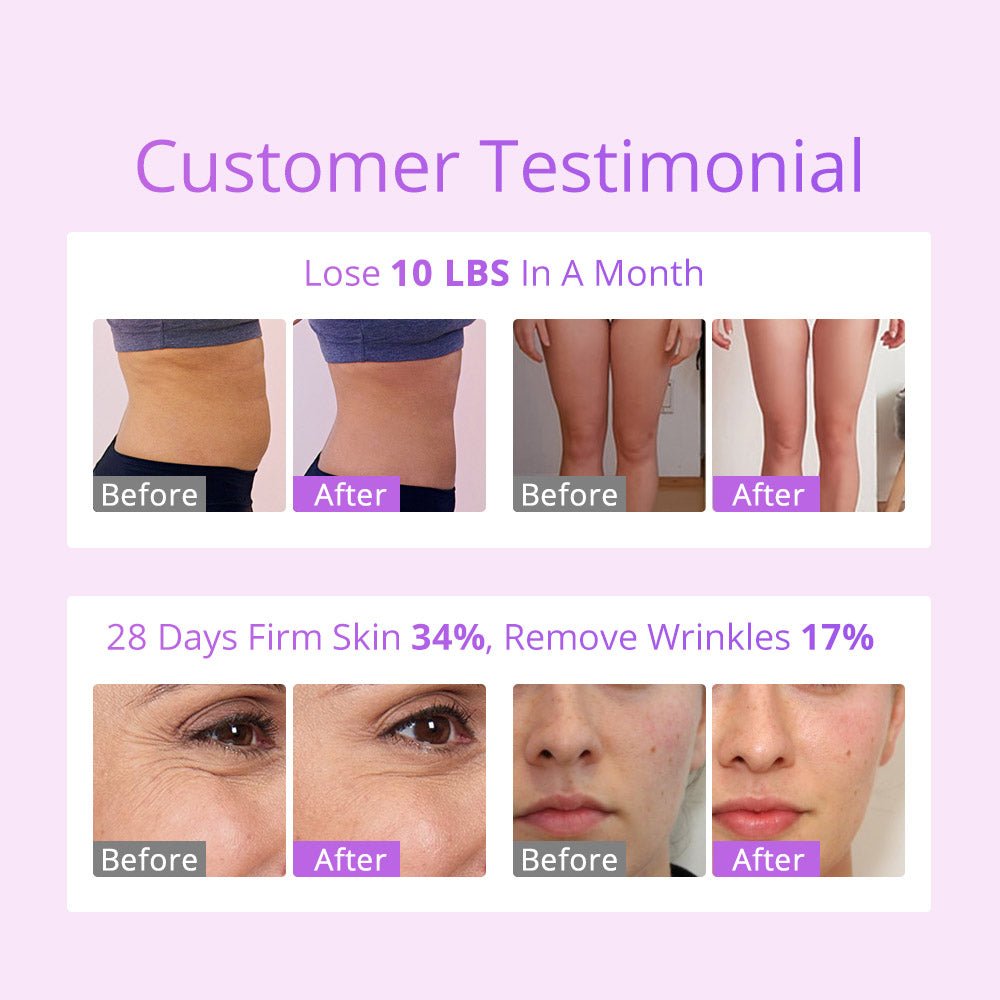 Shape Tactics S-Shape 30K Cavitation 5MHz RF EMS Electroporation & LED Laser Lipo System