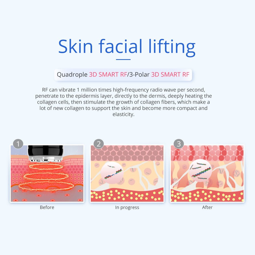 Shape Tactics 6-in-1 Unoisetion Cavitation RF & 160mW LED Laser Body Contouring System