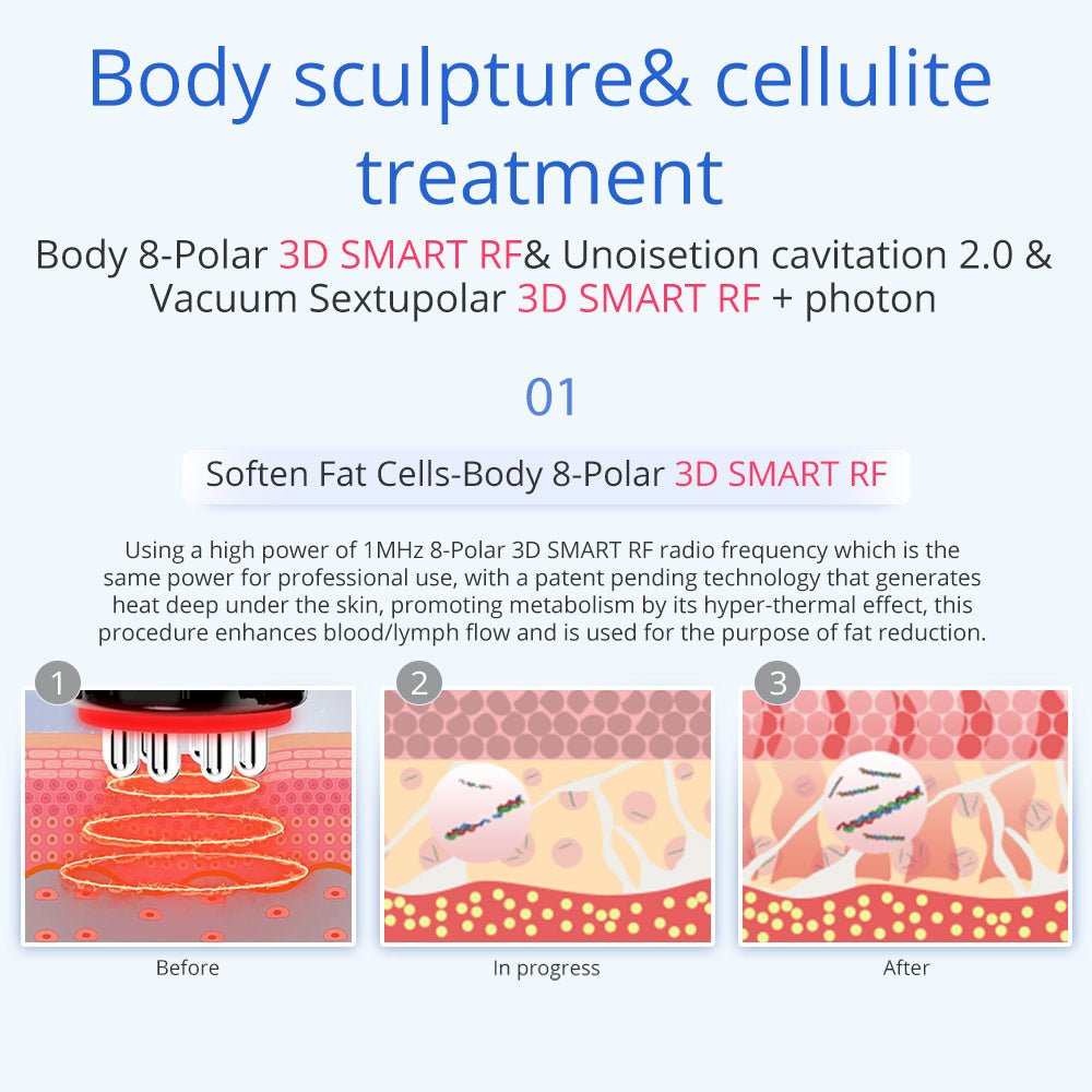 Shape Tactics 6-in-1 Unoisetion Cavitation RF & 160mW LED Laser Body Contouring System