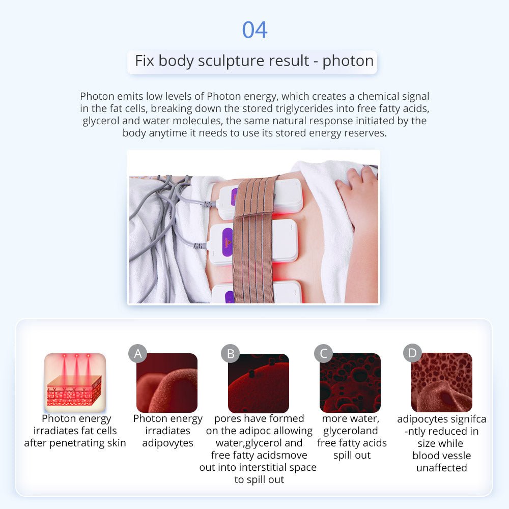 Shape Tactics 6-in-1 Unoisetion Cavitation RF & 160mW LED Laser Body Contouring System