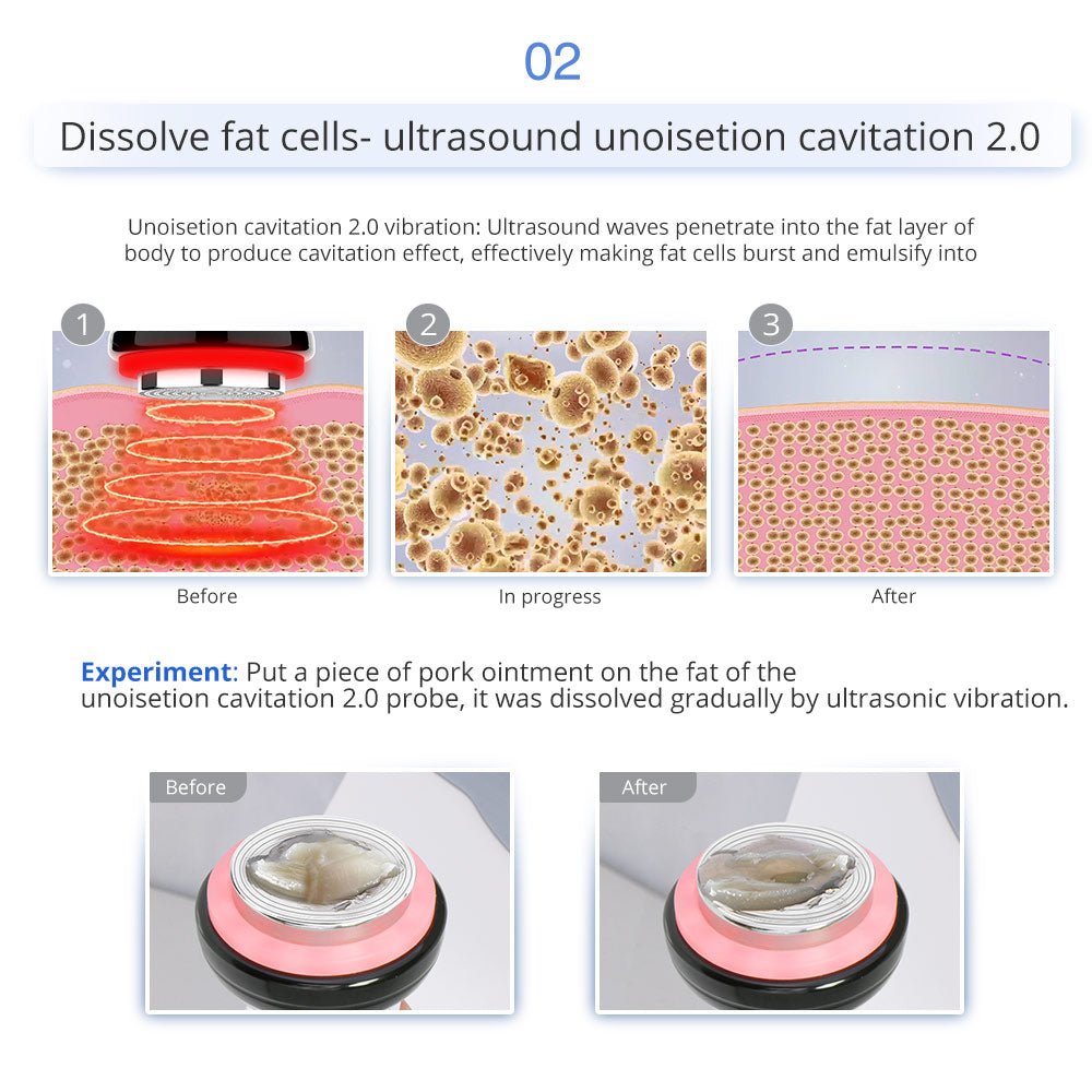 Shape Tactics 7-in-1 40K Cavitation Multi-Polar RF BIO Lift & Hot-Cold Therapy System