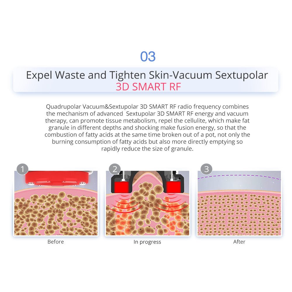 Shape Tactics 7-in-1 40K Cavitation Multi-Polar RF BIO Lift & Hot-Cold Therapy System