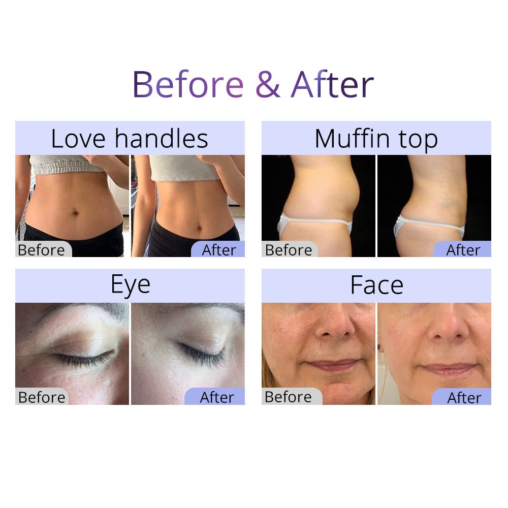 Shape Tactics 9-in-1 Cavitation RF LED Laser Lipo & Skin Rejuvenation System