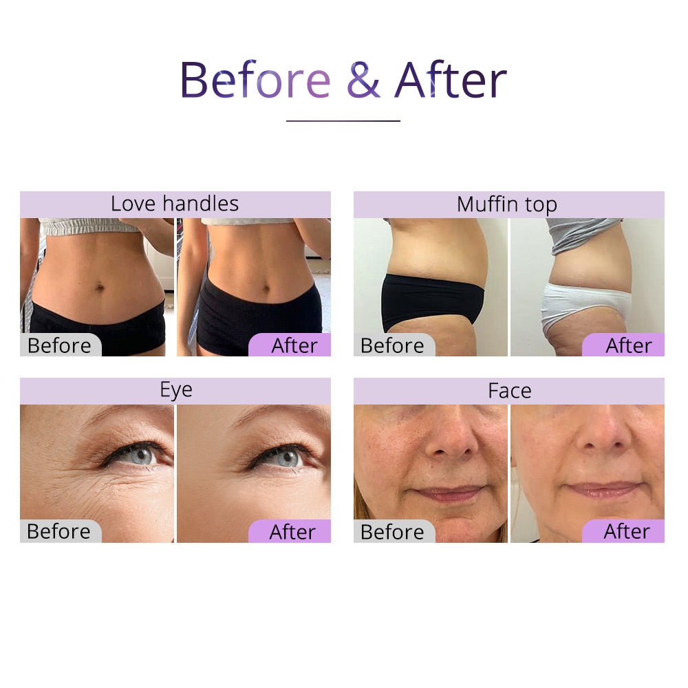 Shape Tactics 5-in-1 40K Cavitation 3D SMART RF & Vacuum Photon Body Contouring System